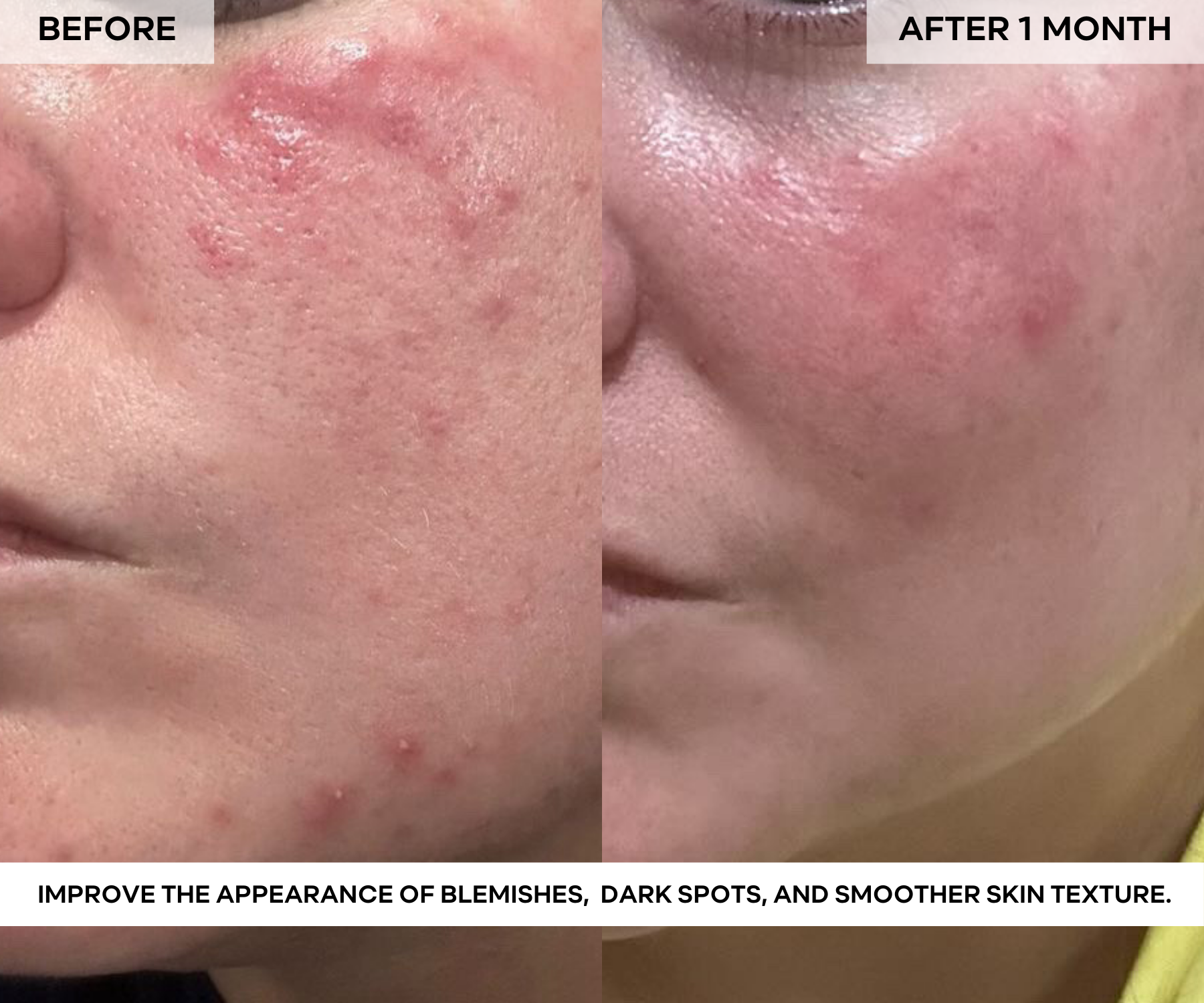 BEAUTY POPS™ Glow Enzyme Frozen Mask Kit